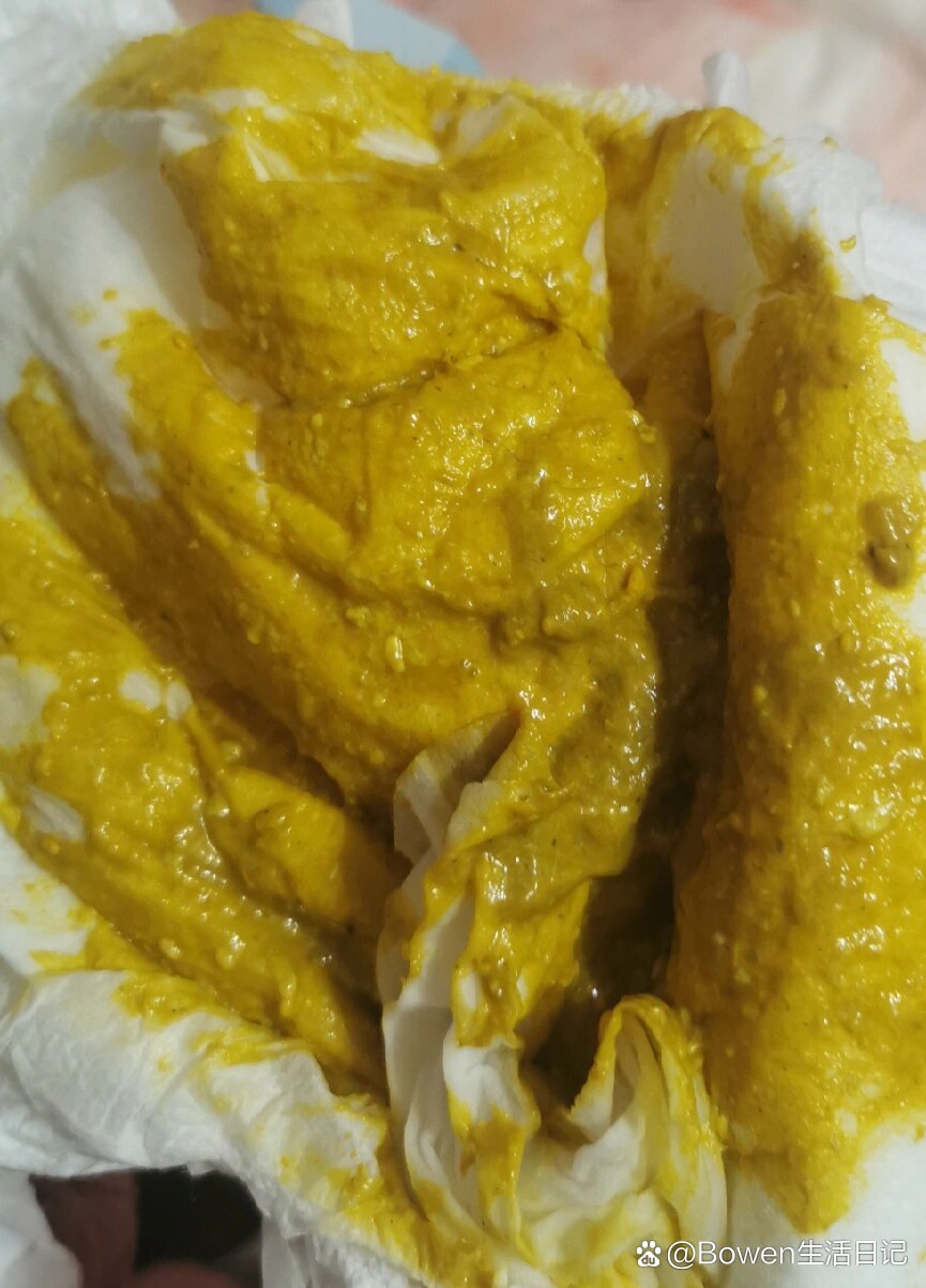 宝宝大便特别臭,饮食不当要调整
