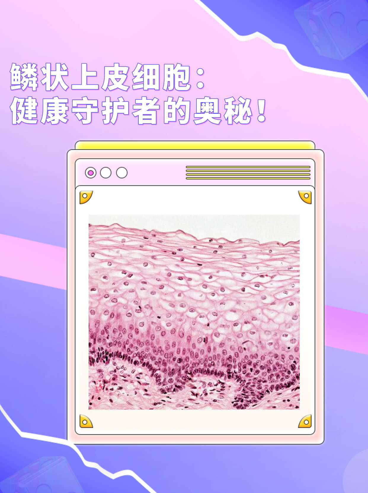 鳞状上皮细胞:健康守护者的奥秘!