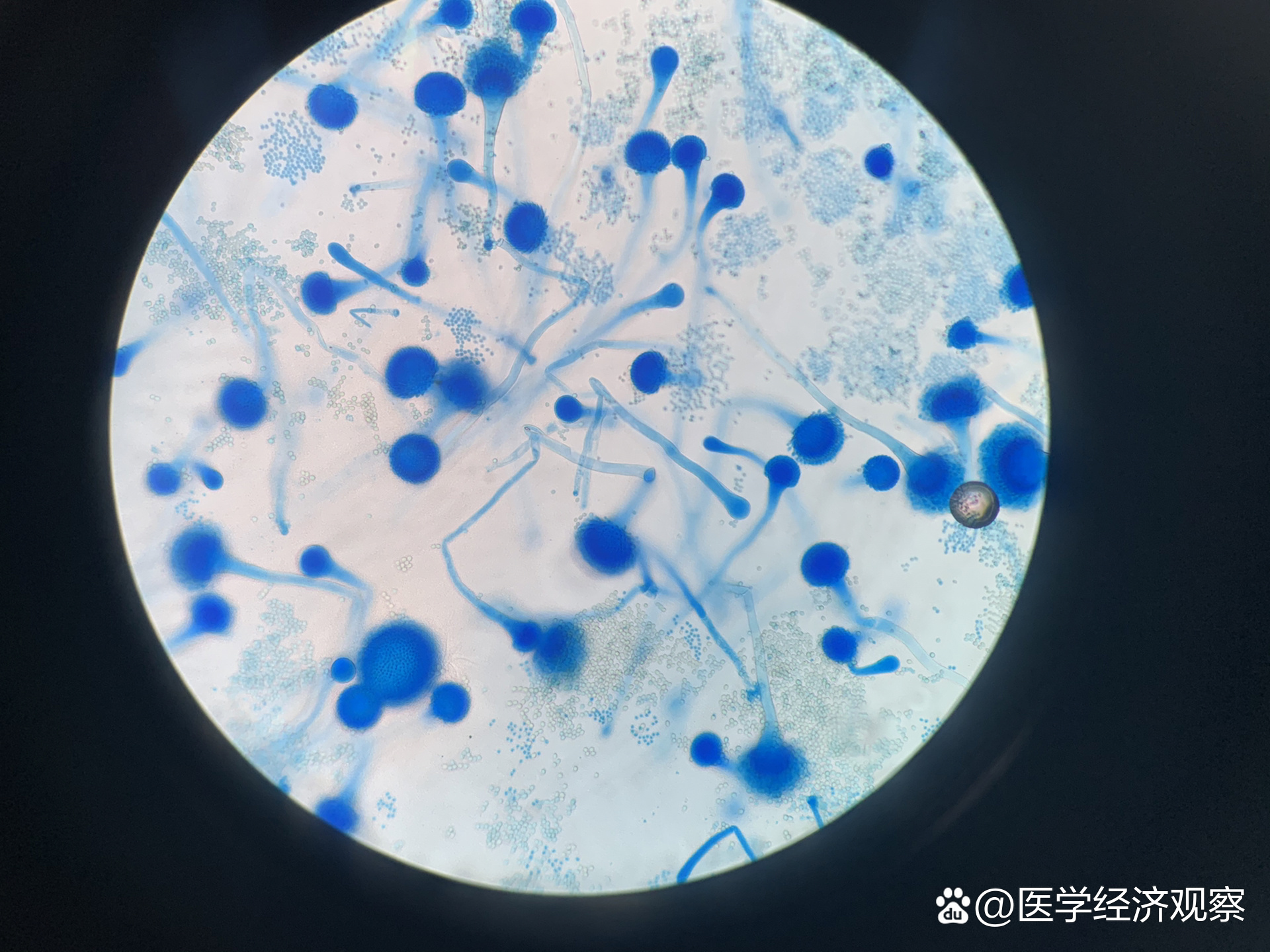 今天给大家分享一组真菌培养及镜下形态图