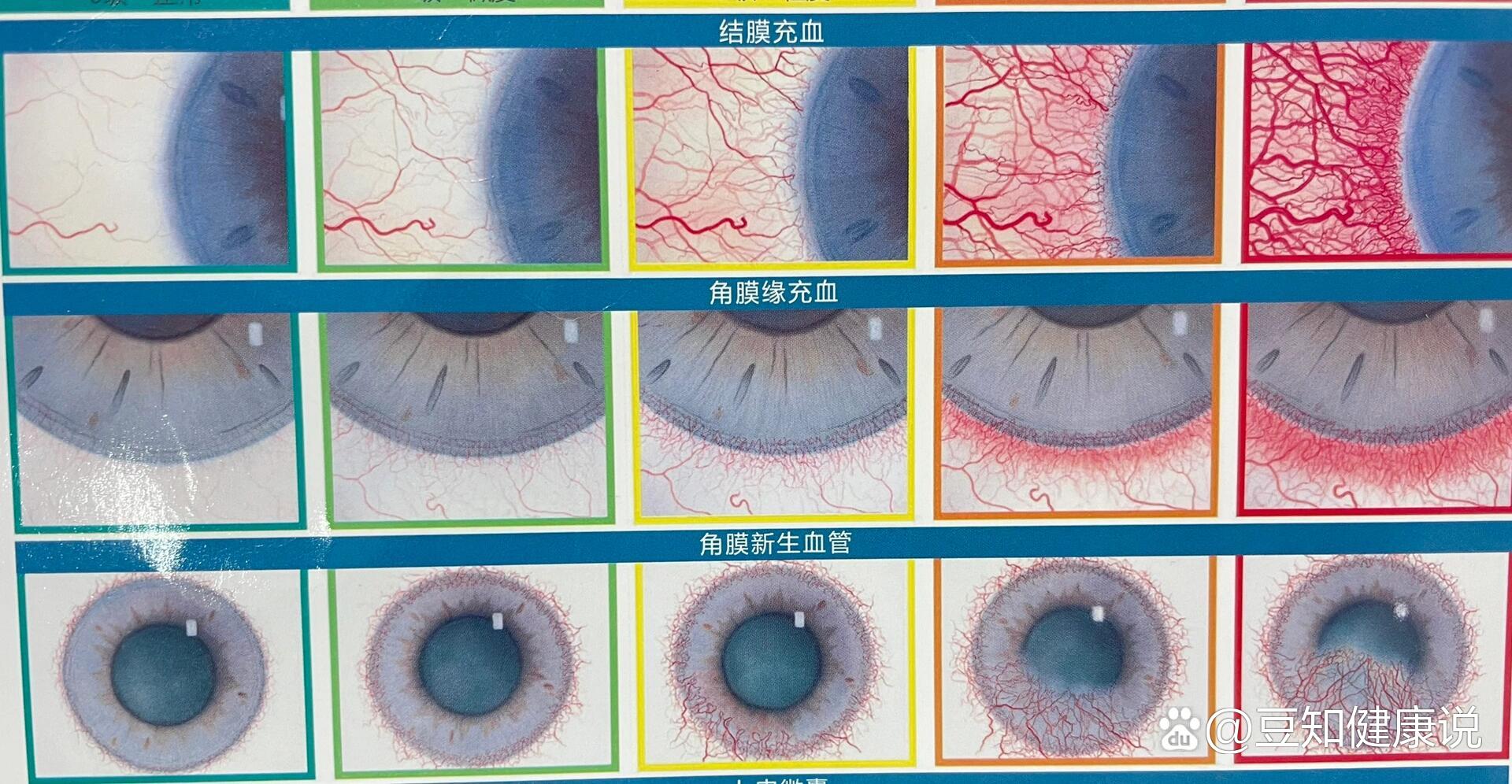 如泪液少,睡眠不好,或者眼部刺激  br