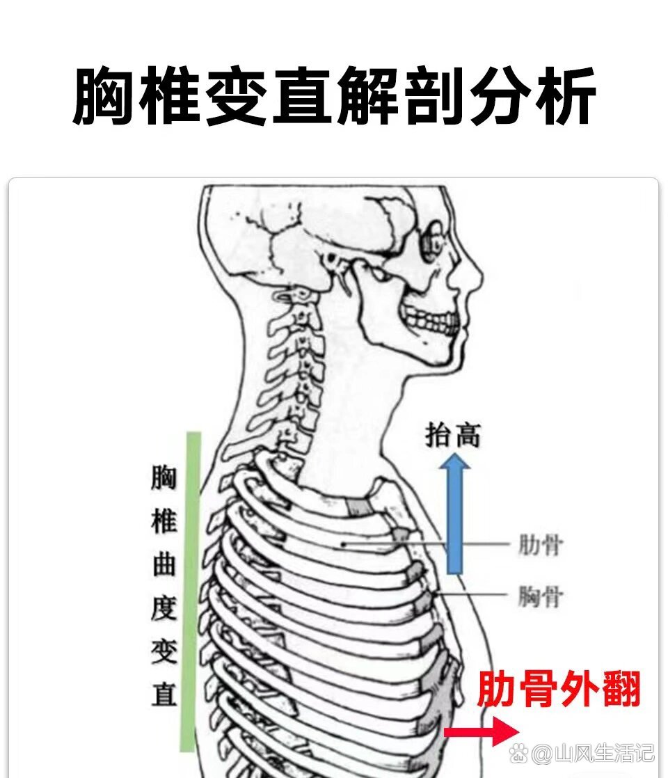 胸椎横突肋凹图片