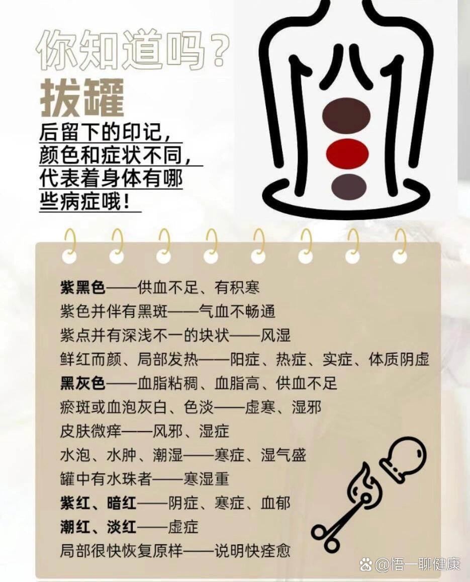 火罐颜色症状对照表图片