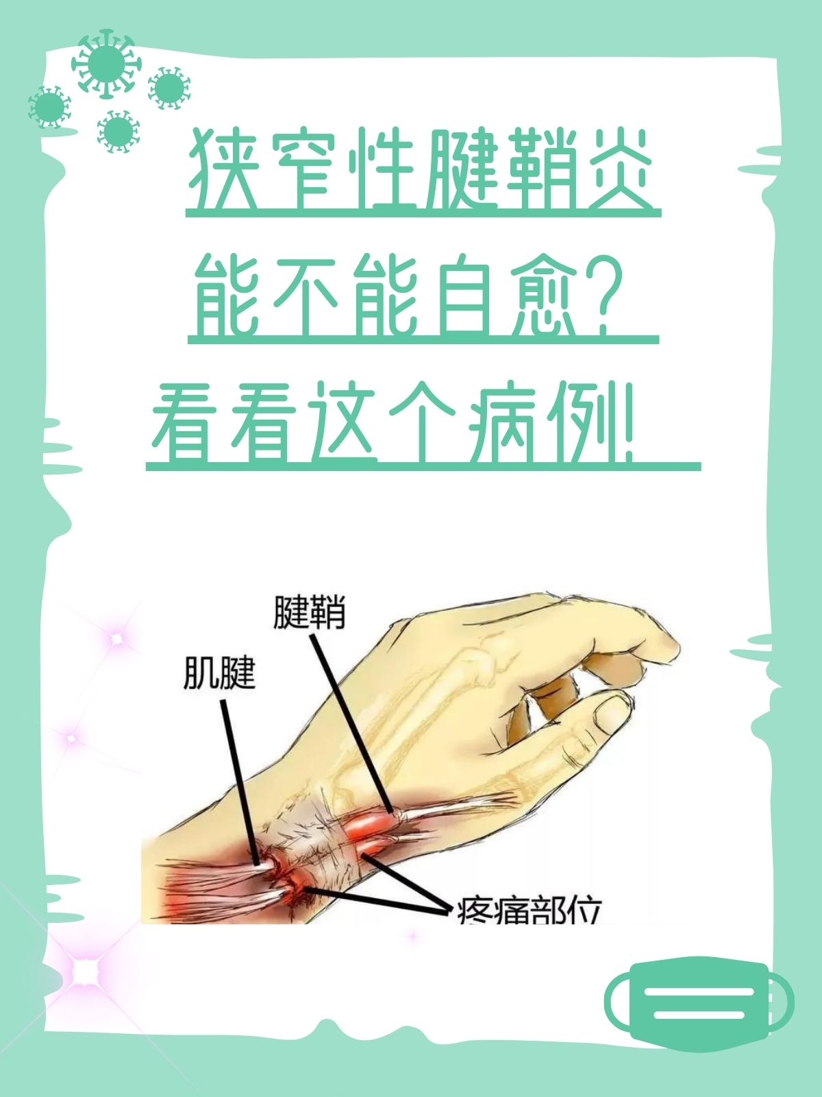 狭窄性腱鞘炎病历模板图片