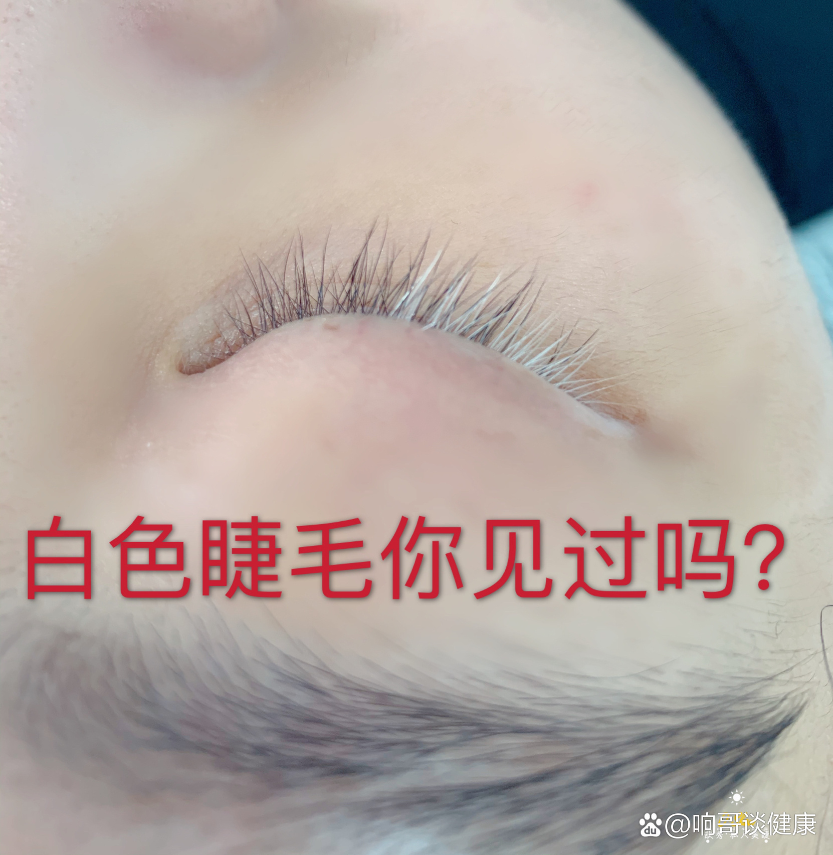 白色睫毛你见过吗?