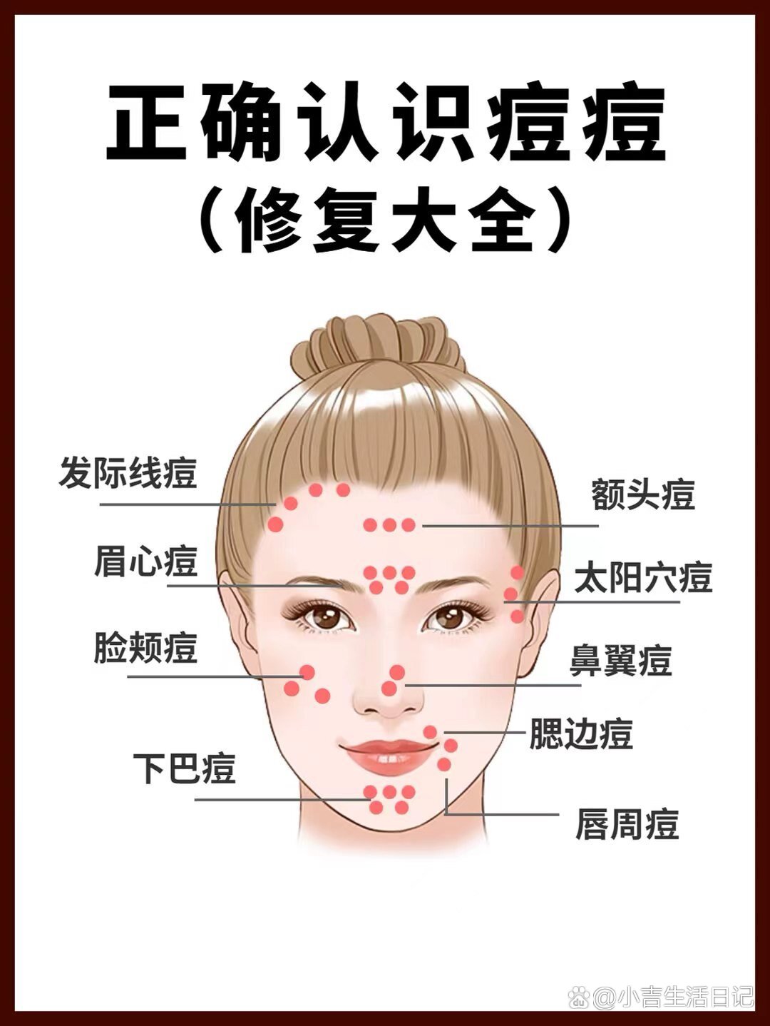 痘痘分布图解解析图片