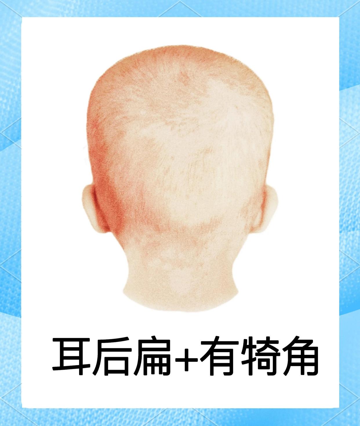👶耳后扁头型纠正全攻略📖