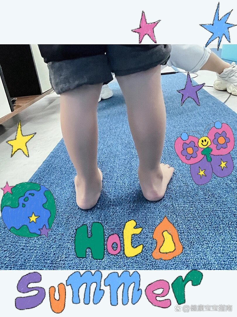 你家孩子脚后跟是歪的吗?