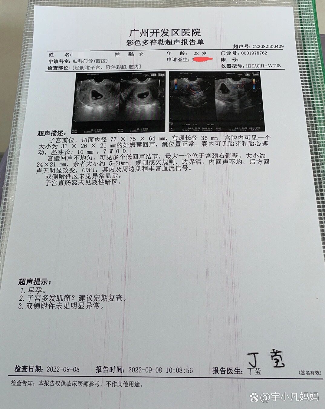 阴超 怀孕图片