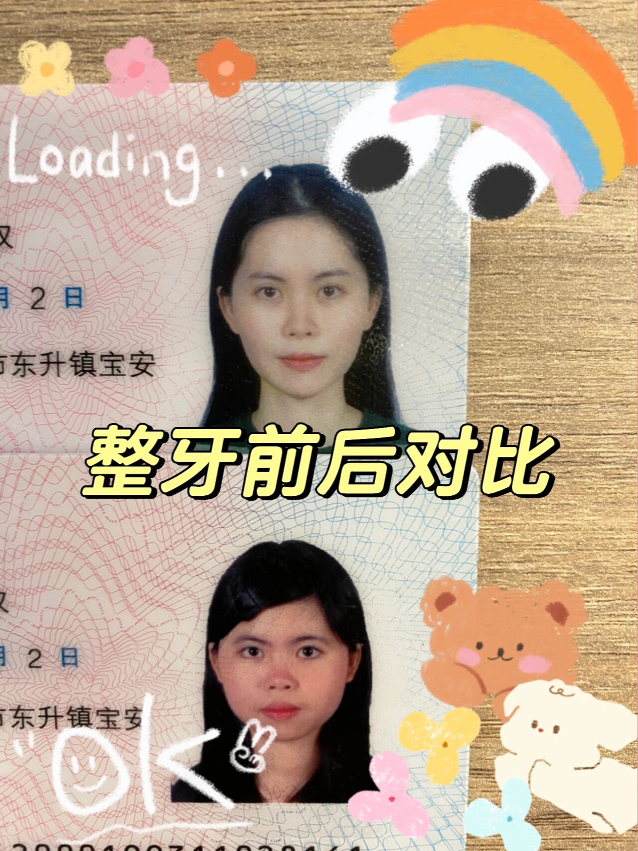 我豁出去了,整牙前后对比照来了!