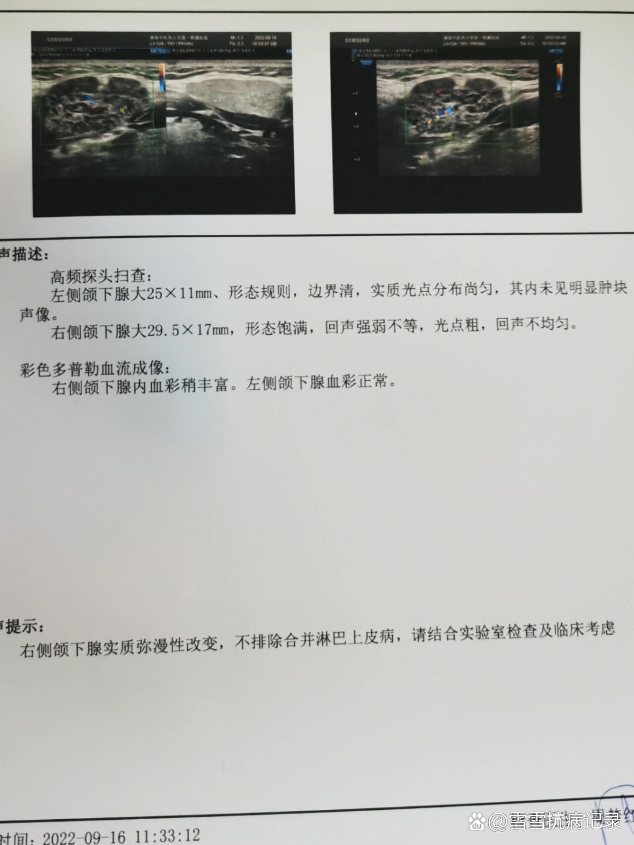 包含瑞金医院号贩子挂号电话，挂不上的都找我-的词条