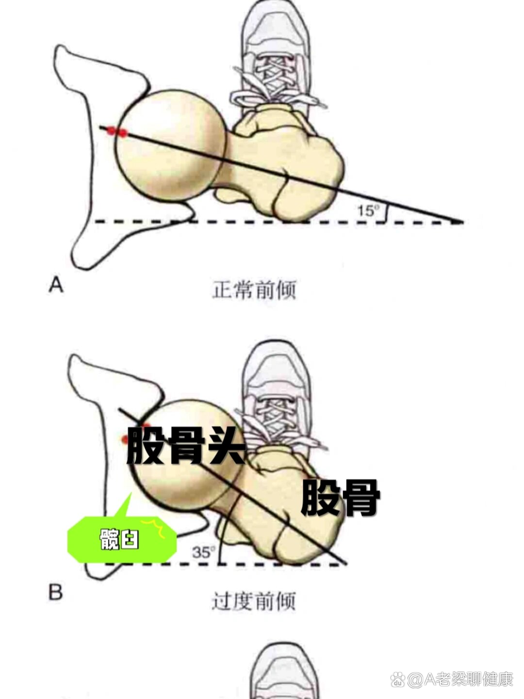 小胯是哪个部位图片