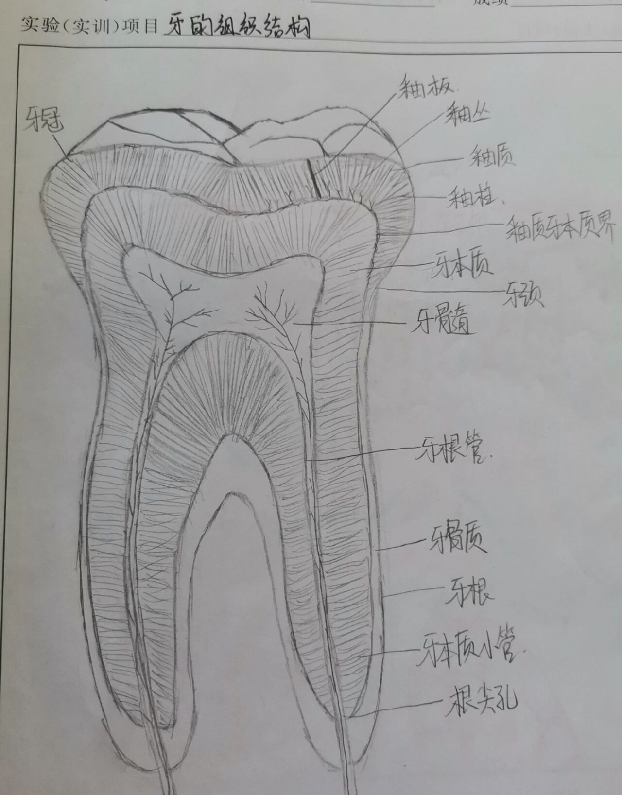 牙本质结构图片