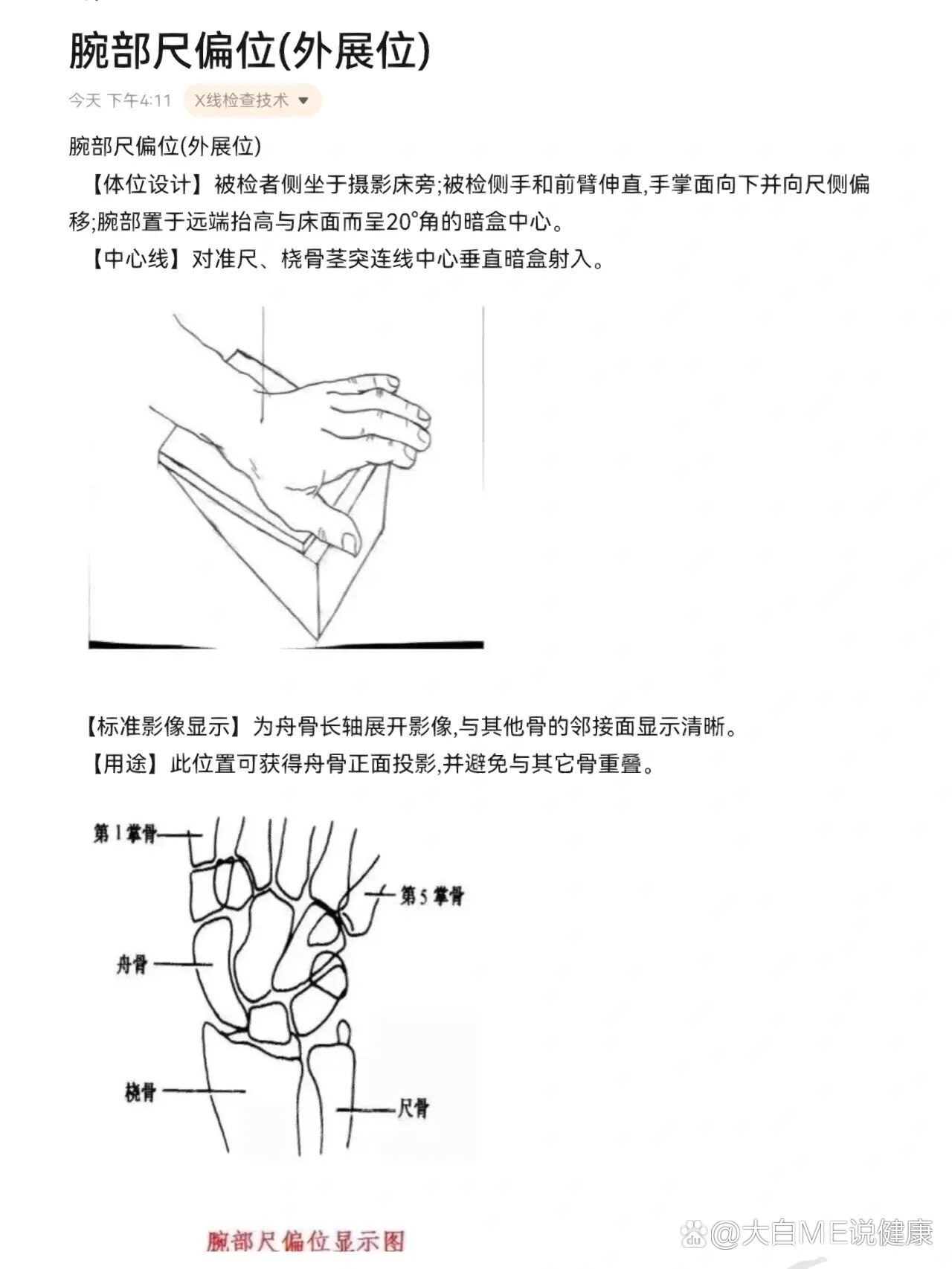 腕关节尺偏桡偏图片