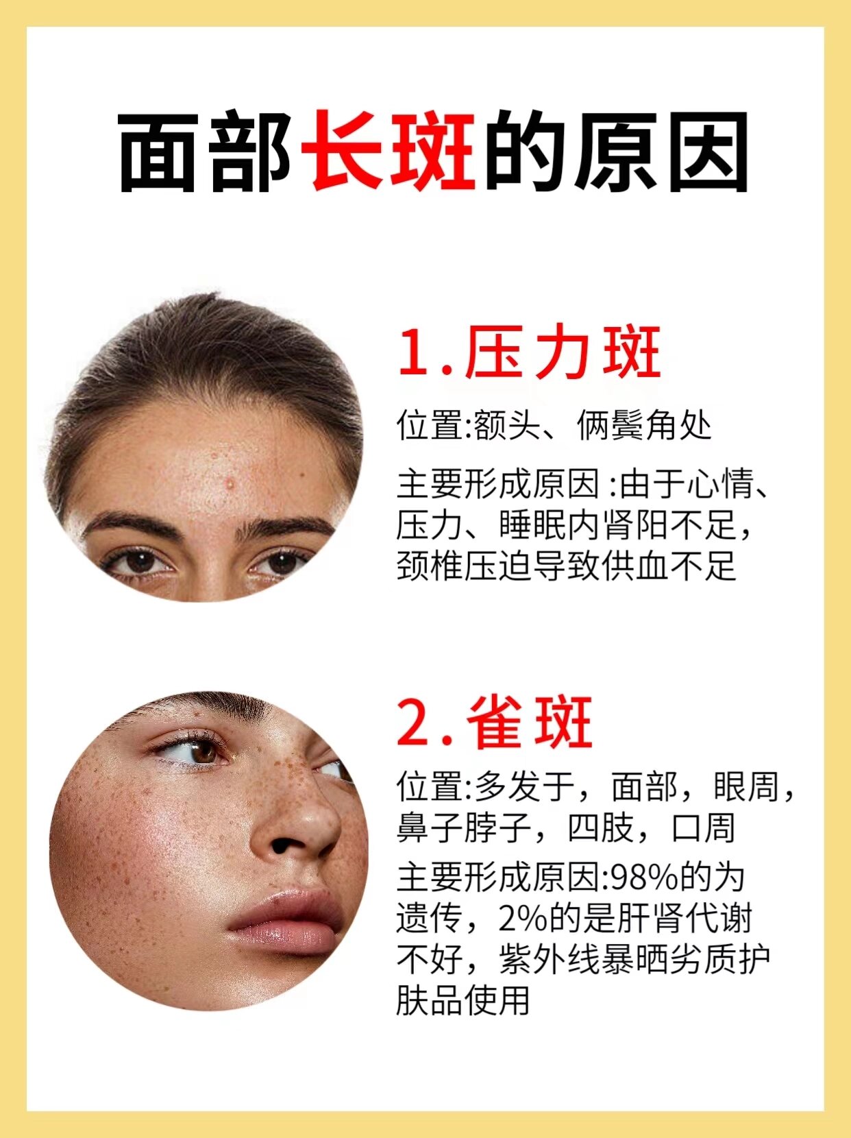 脸上不同位置长斑原因