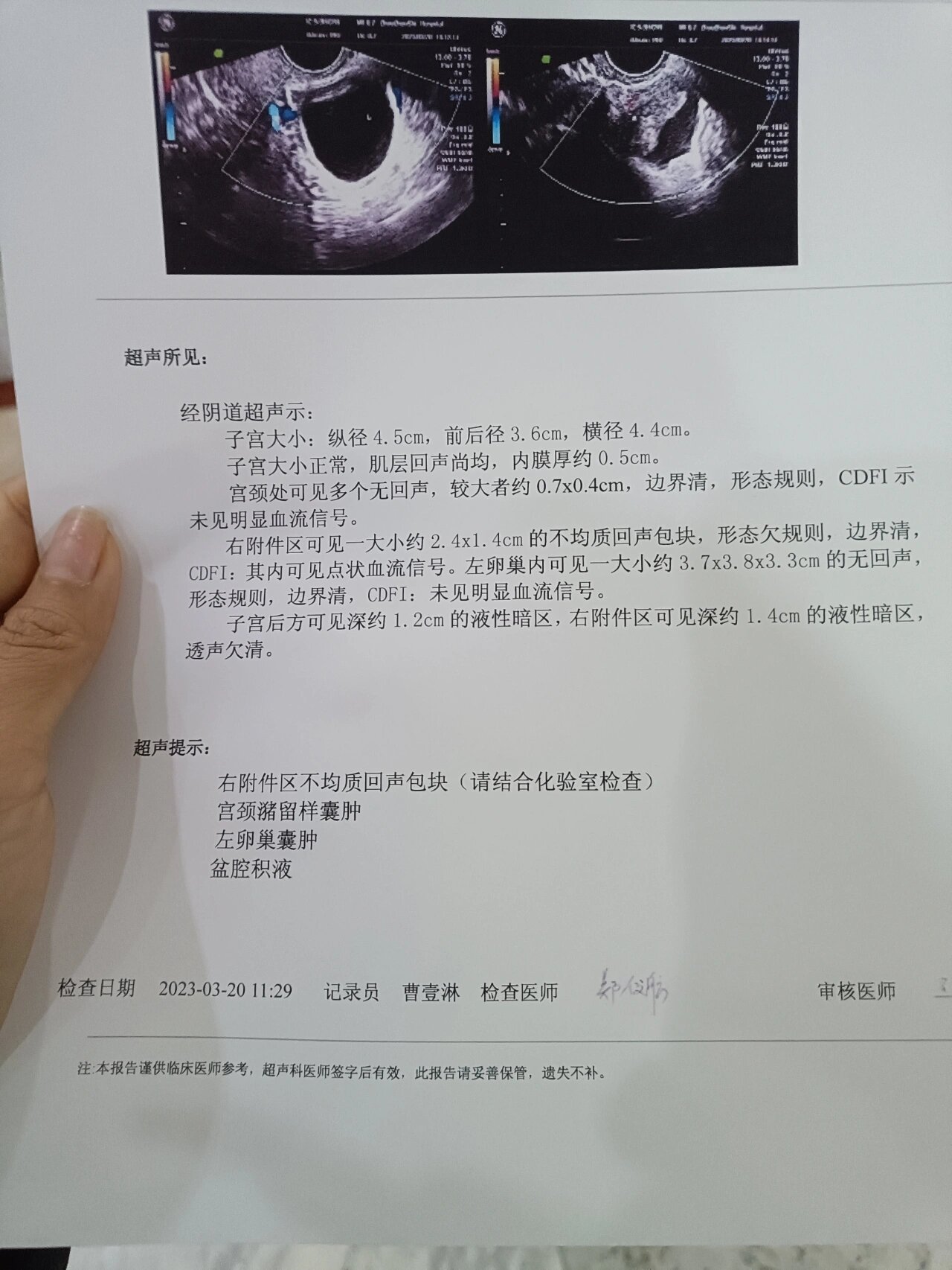 今天又要求做了阴超,还是有血流信号,保守半个月了血值一直不理想,一