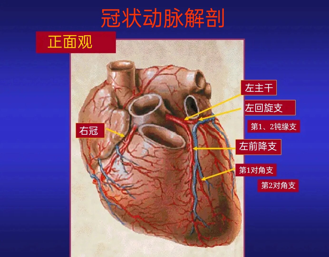 什么是冠心病图片