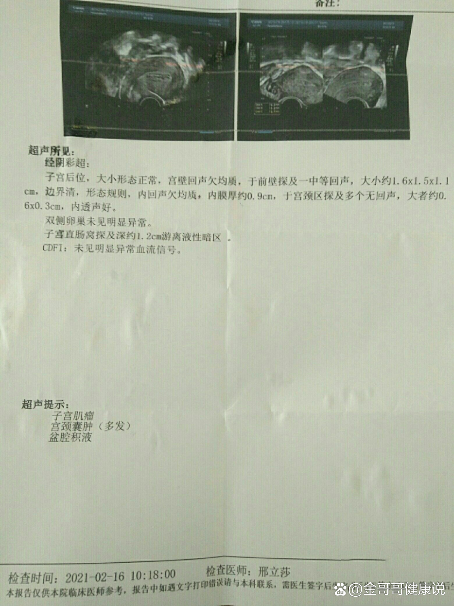 阴超显示宫颈前壁有个子宫肌瘤我就特别害怕觉得二十多天就能长个肌瘤