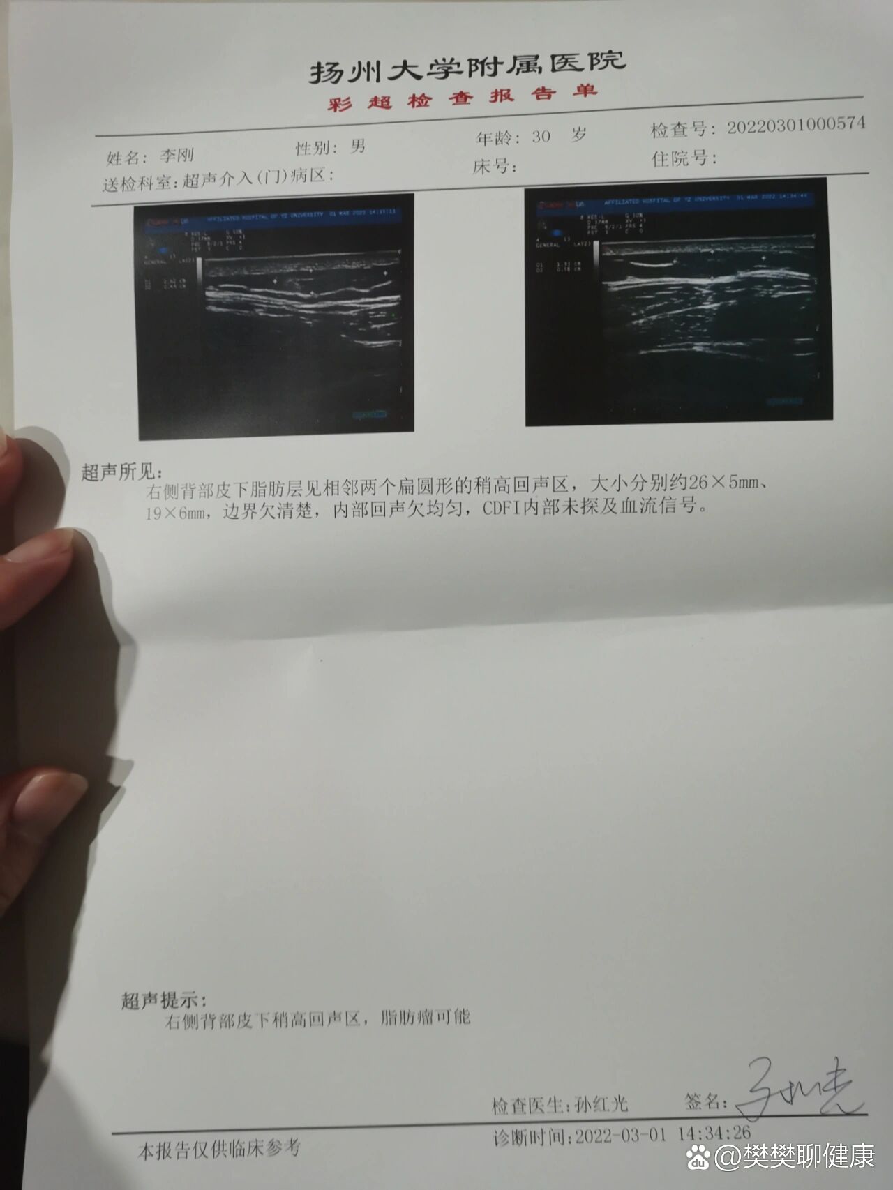 乳腺脂肪瘤彩超图像图片