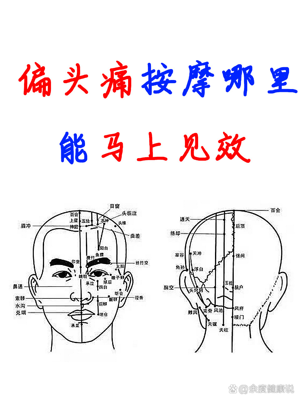 偏头痛是哪个位置图片图片