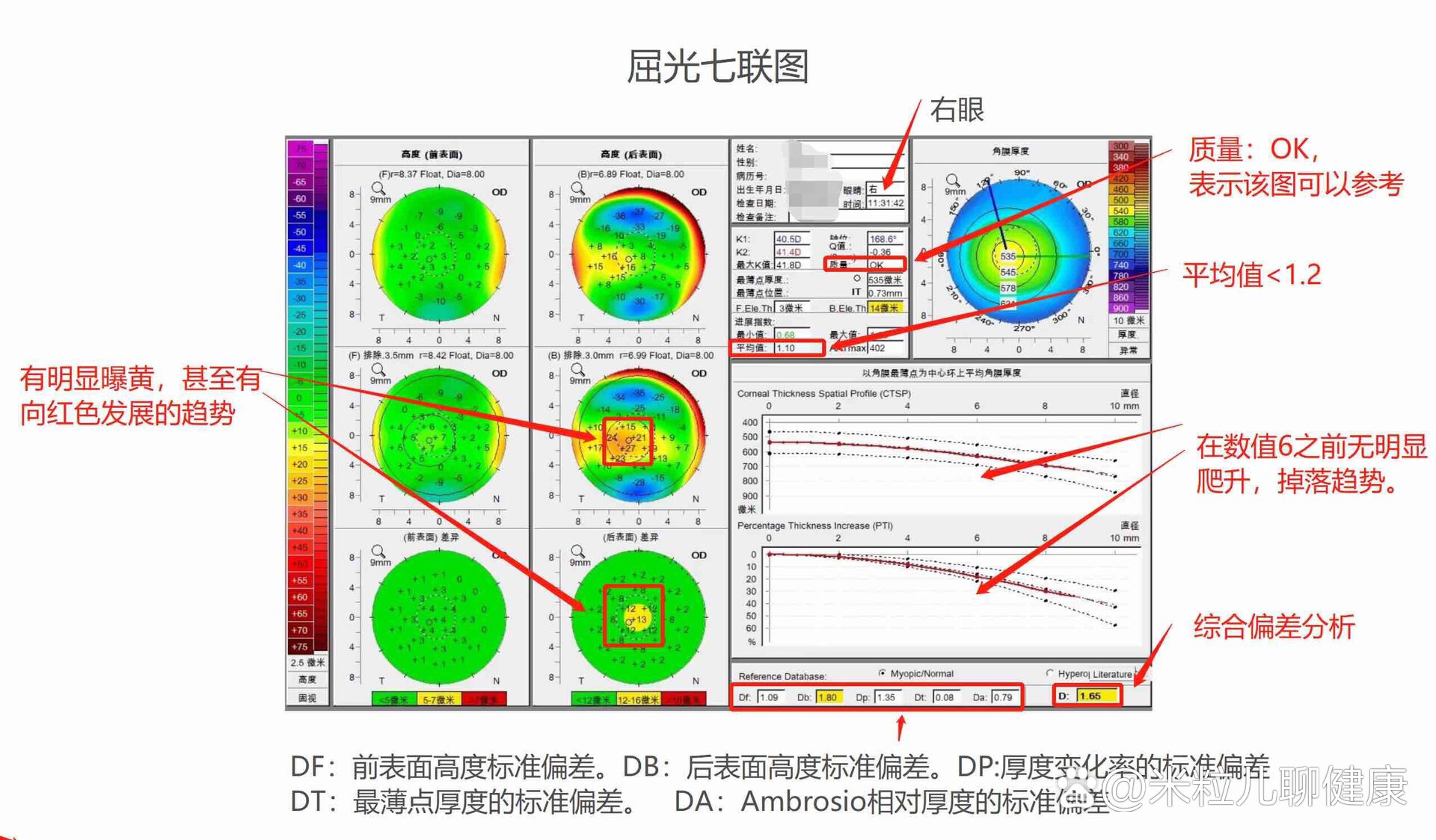 下看角膜地形图的大概流程  br