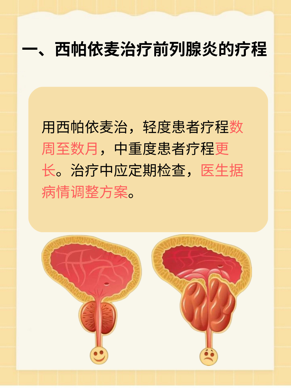 西帕依麦治疗前列腺炎,多久才能见效?