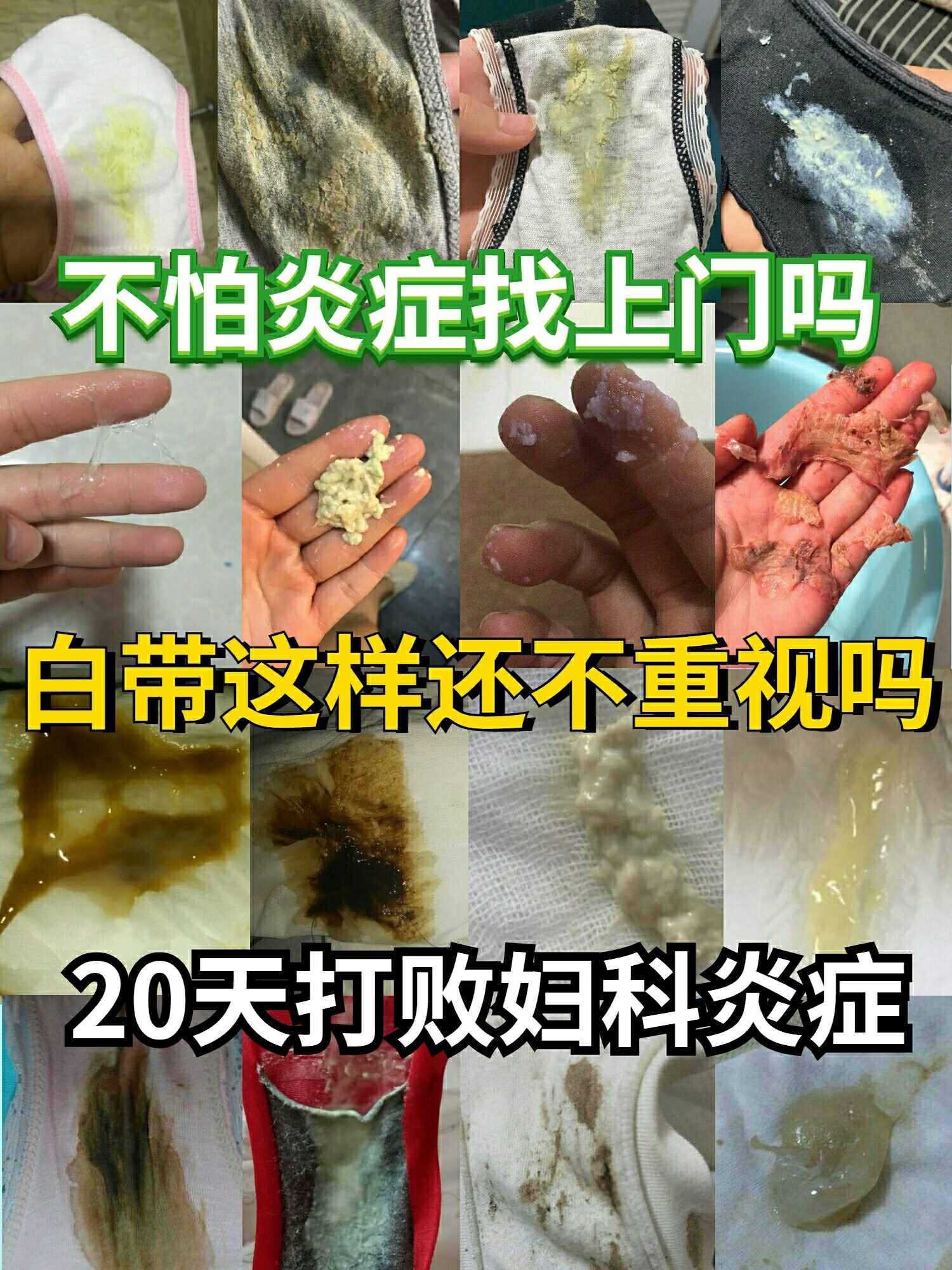 内裤总是异味?