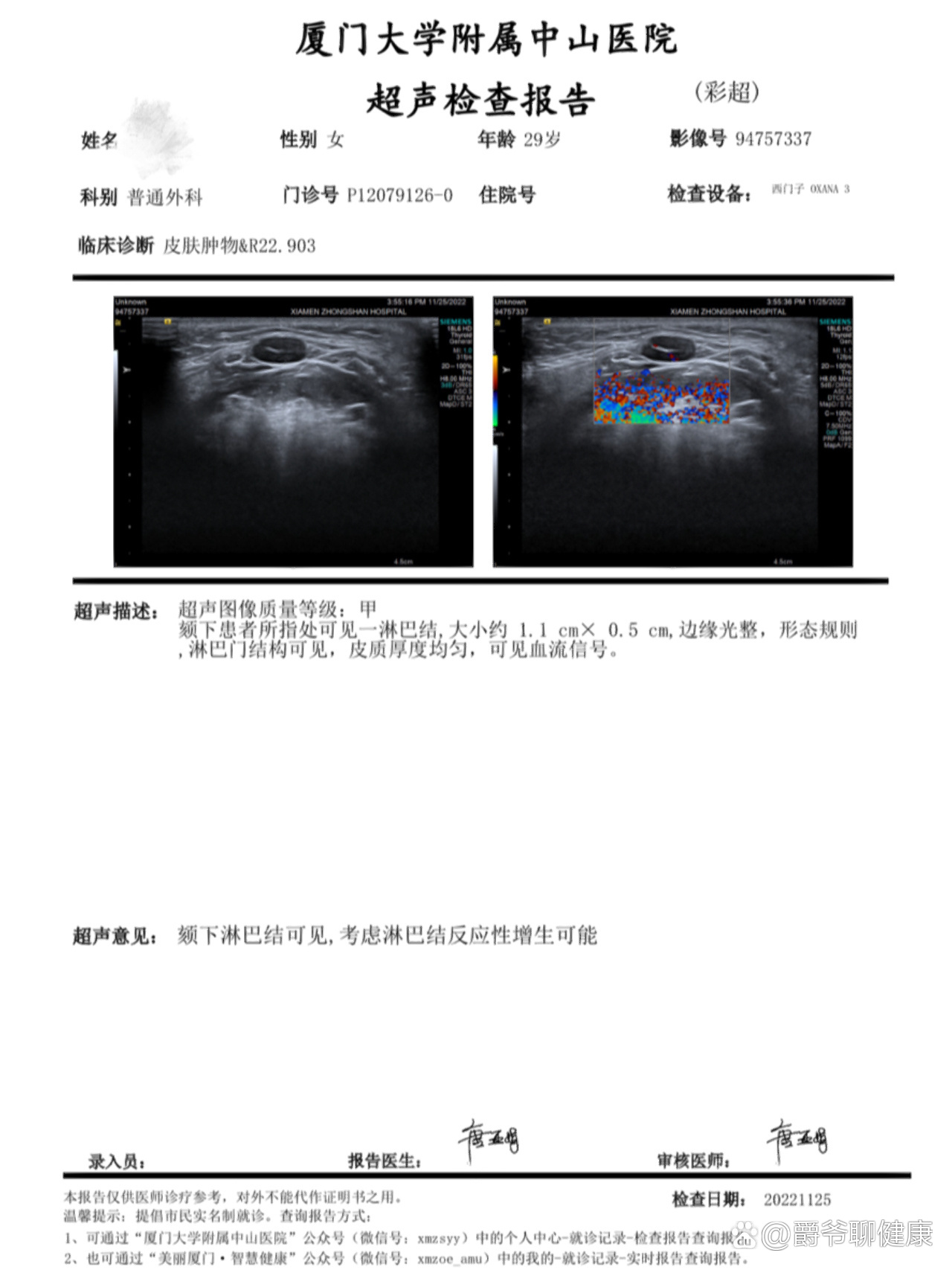 下巴淋巴结肿大怎么办图片