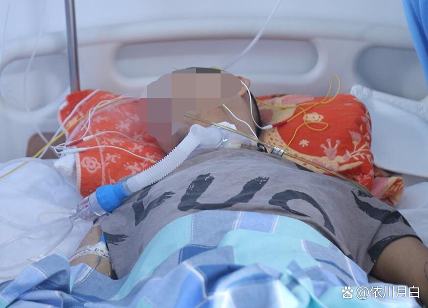 植物人促醒都有哪些方案?