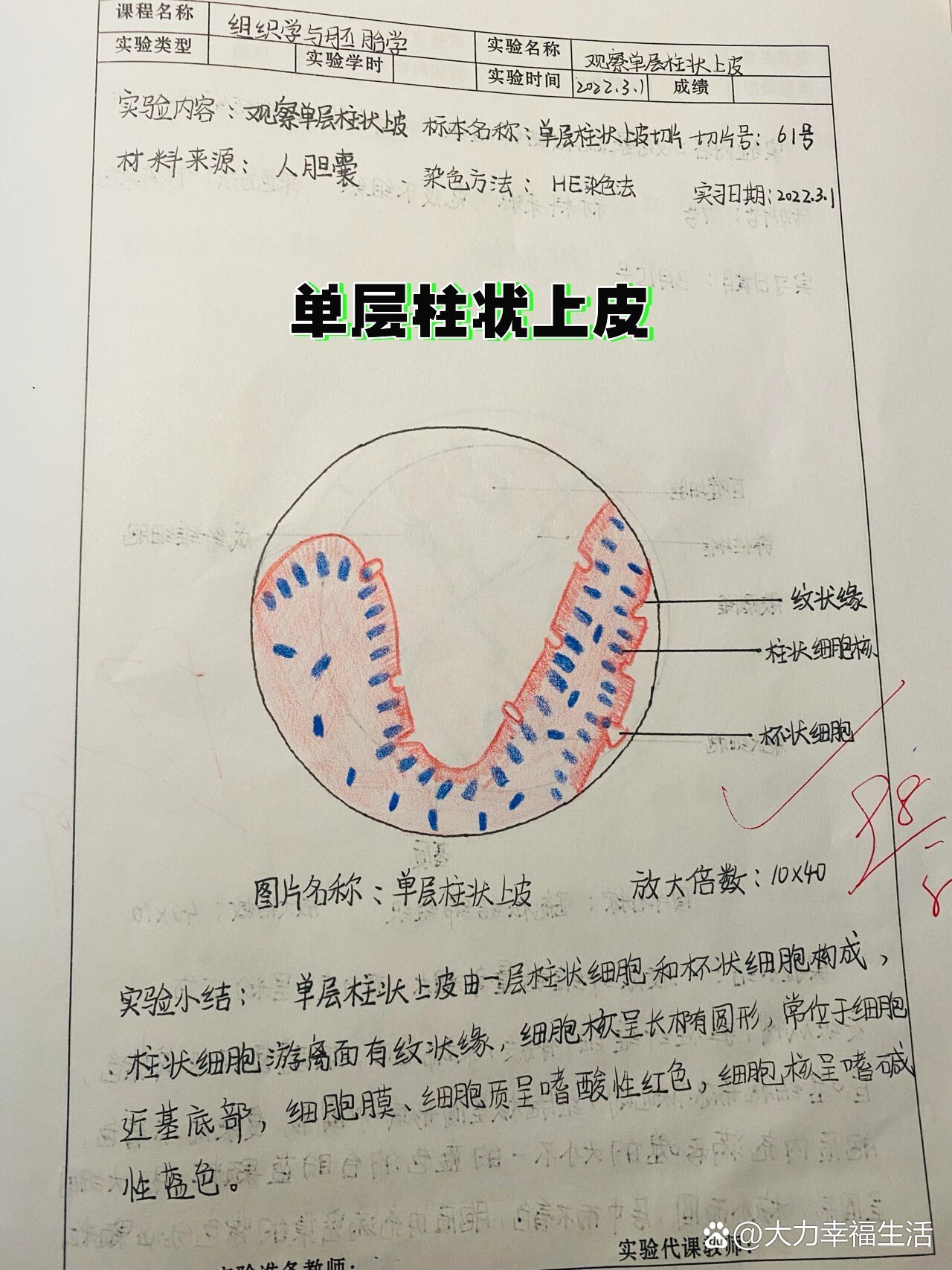 单层柱状上皮图片解析图片