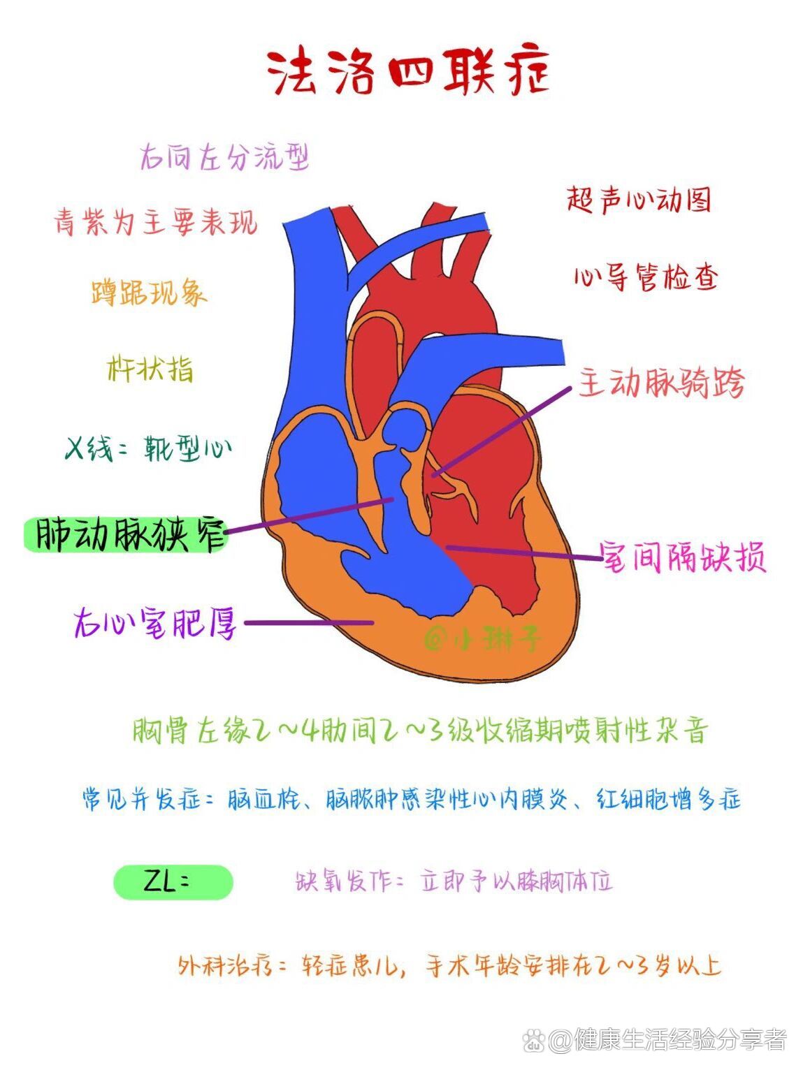 动脉导管未闭x线图片图片