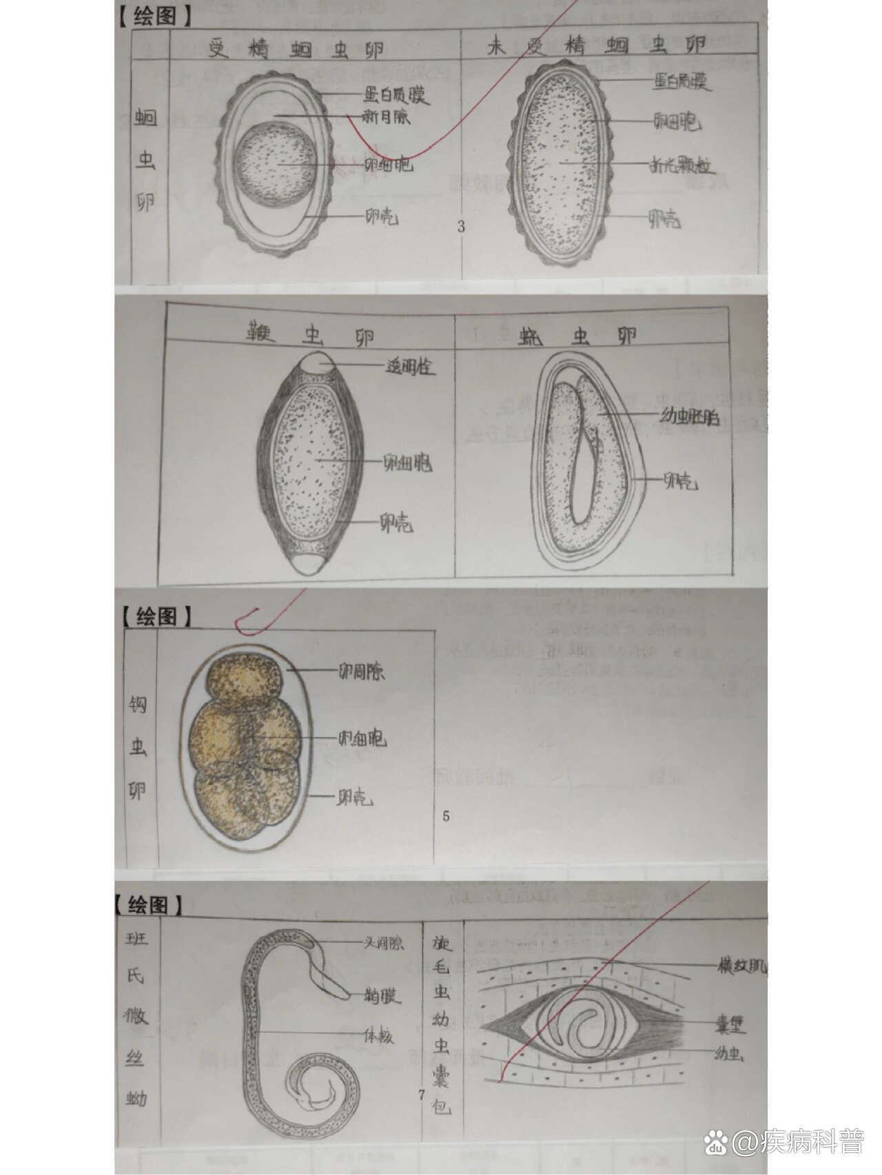 钩虫卵结构示意图标注图片