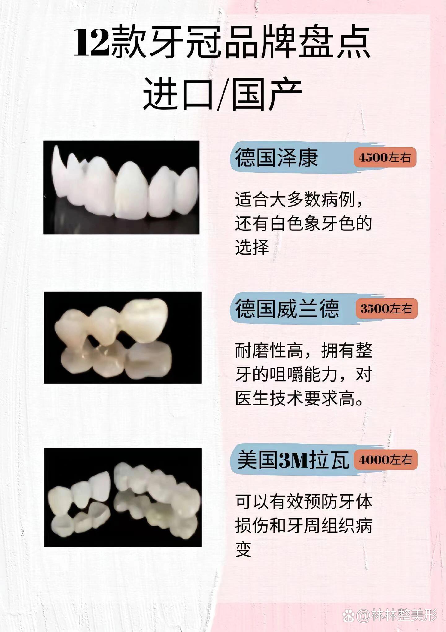 牙冠价格大揭秘