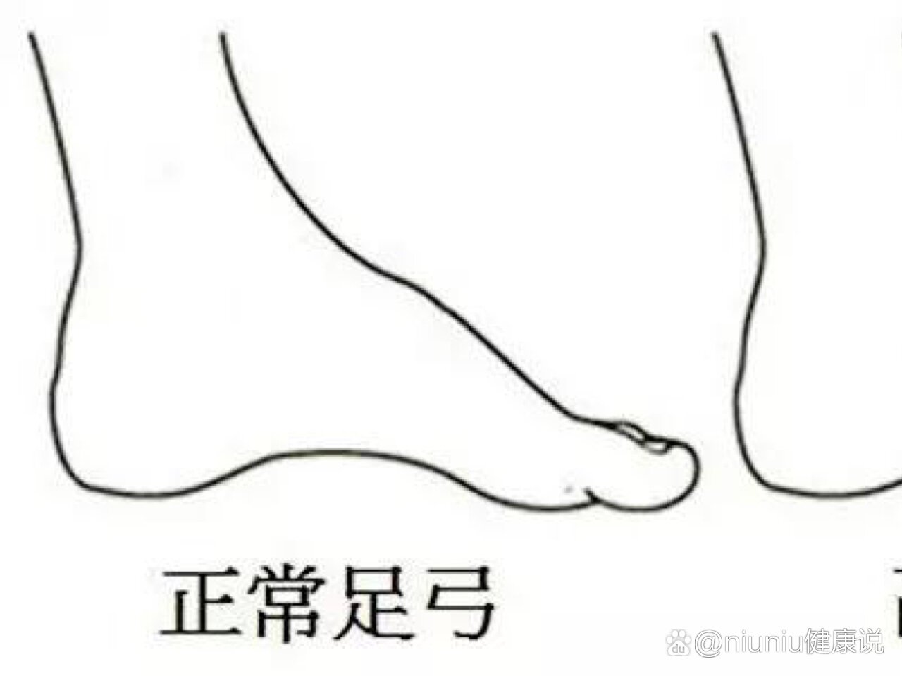来看看你脚背高不高来判断一下你的脚是属于哪种的以后买