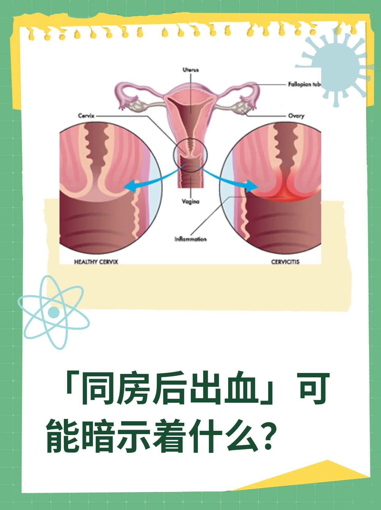 同房后出血」可能暗示着什么