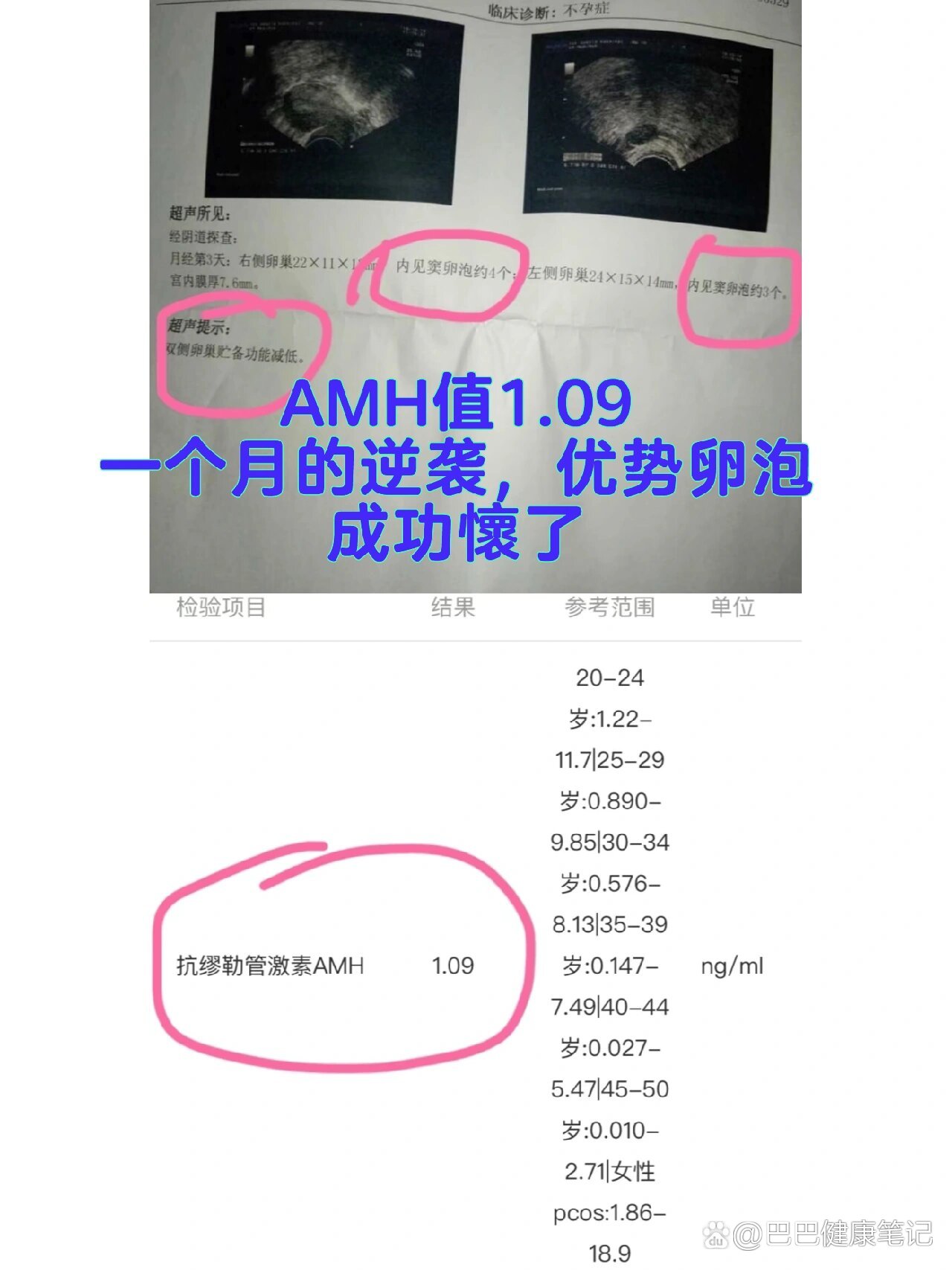 amh值0.01是卵巢早衰_amh值多少为卵巢早衰是09是早衰吗
