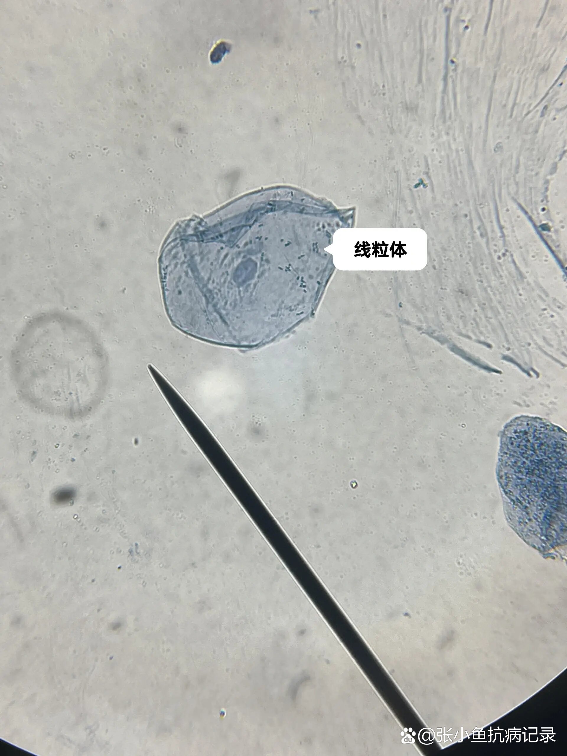 【显微镜下的世界】线粒体的超活染色