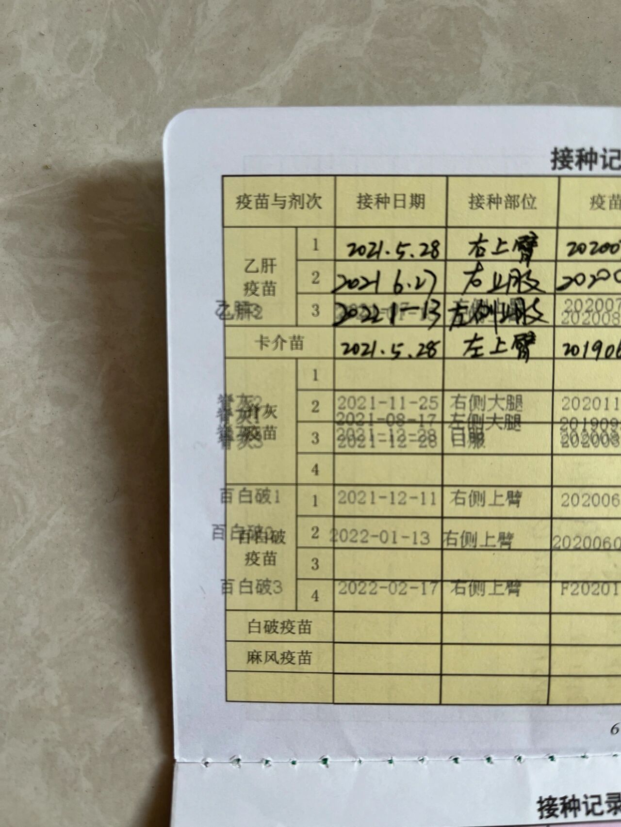 你们的疫苗本也这样吗?