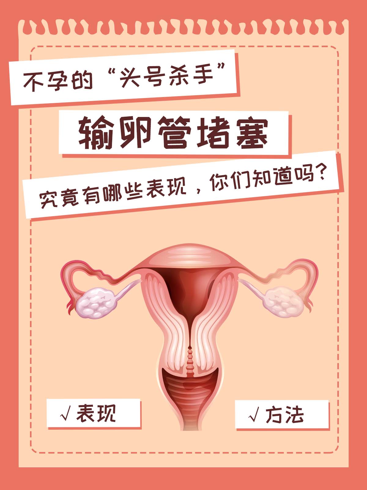 输卵管堵塞,究竟有哪些表现,你们知道吗?
