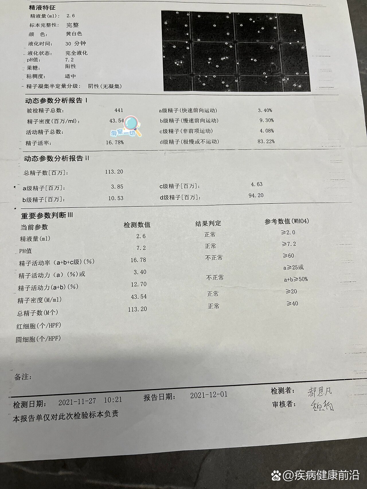 重度弱精症图片