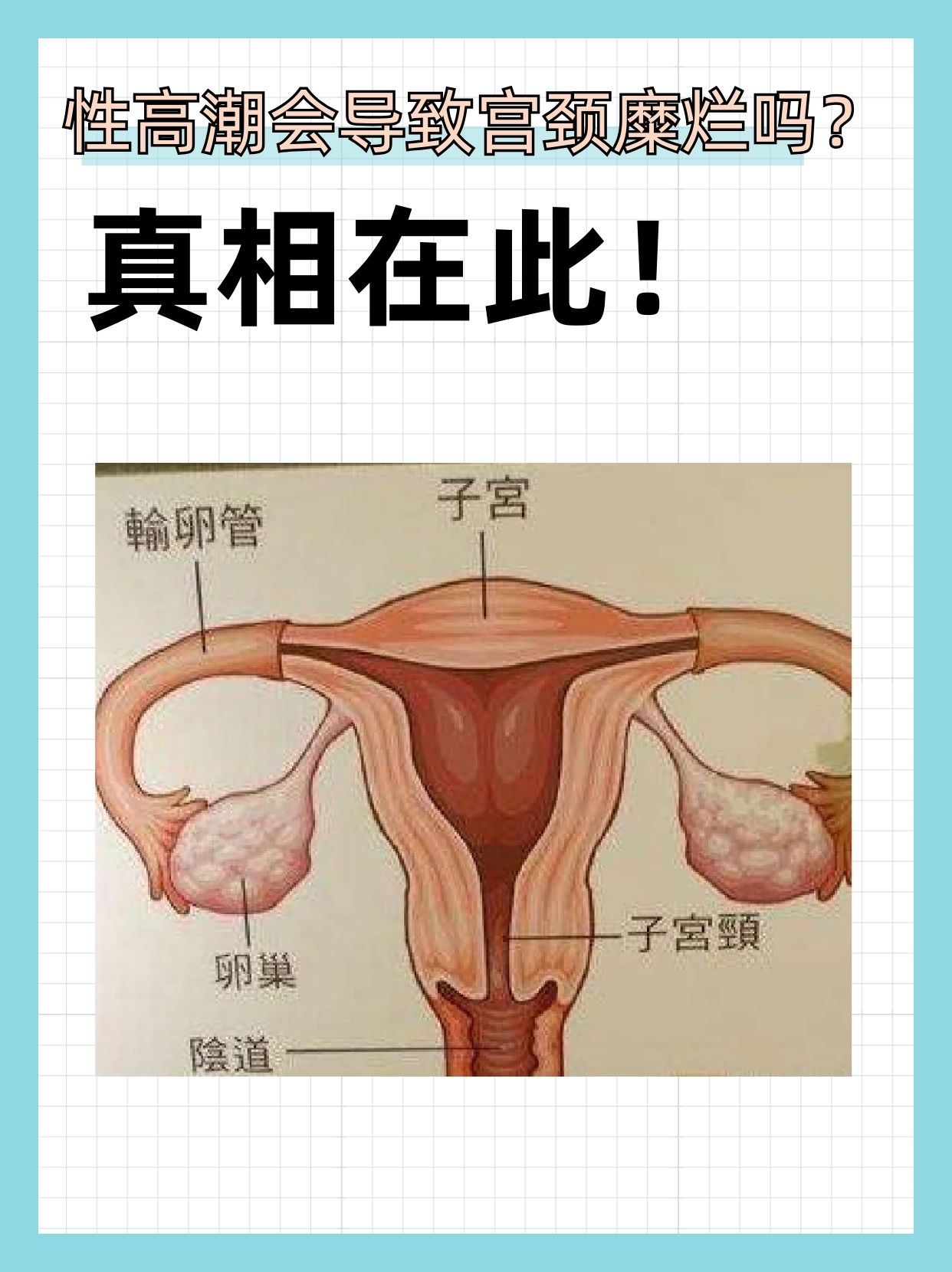 宫颈糜烂会自愈吗图片