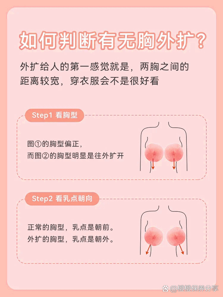 没沟02胸外扩631521566步辨别是否真外扩?