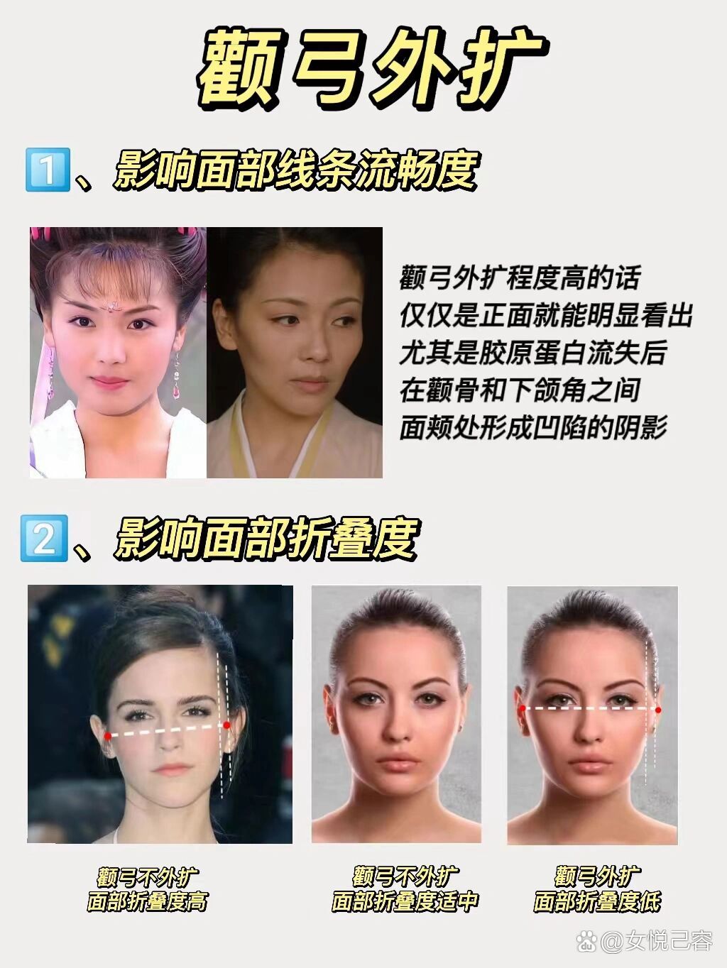 高颧骨VS颧弓外扩 傻傻分不清楚🤯