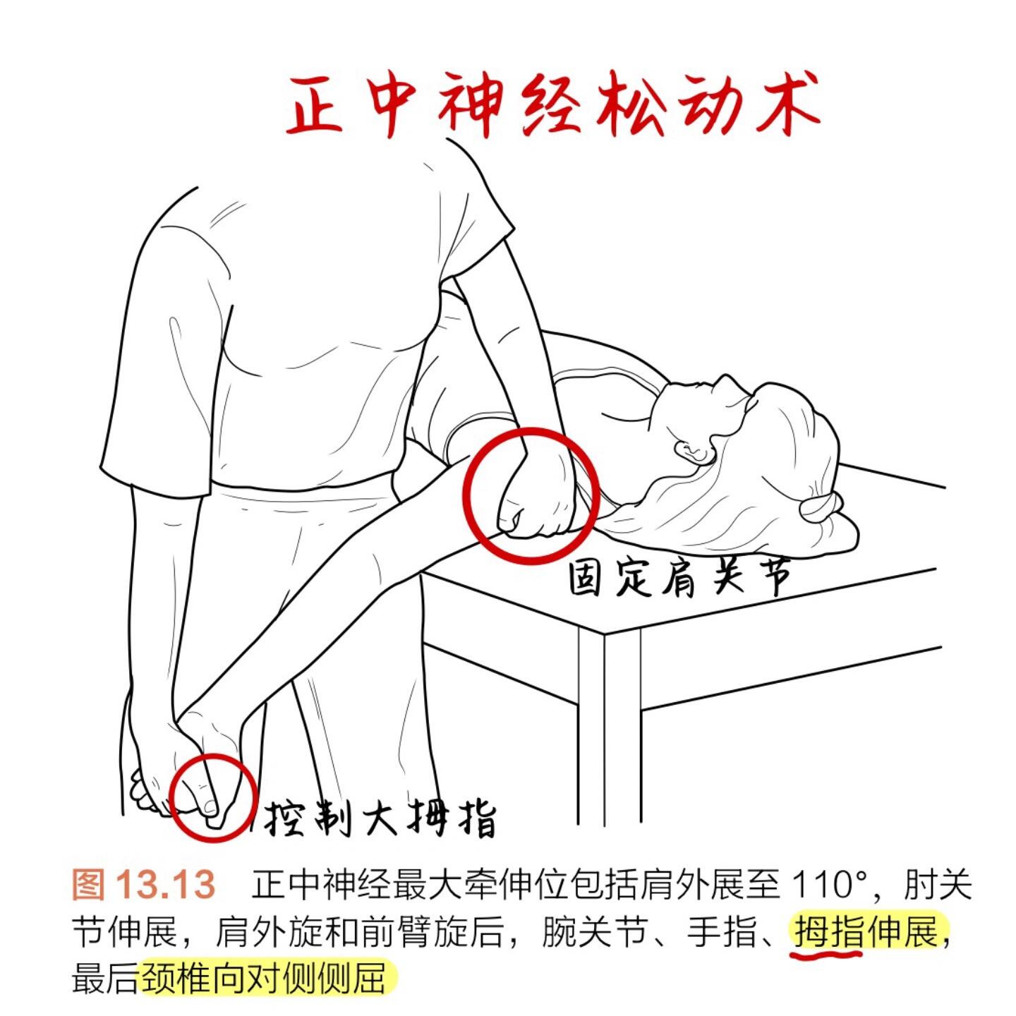 正中神经松动术