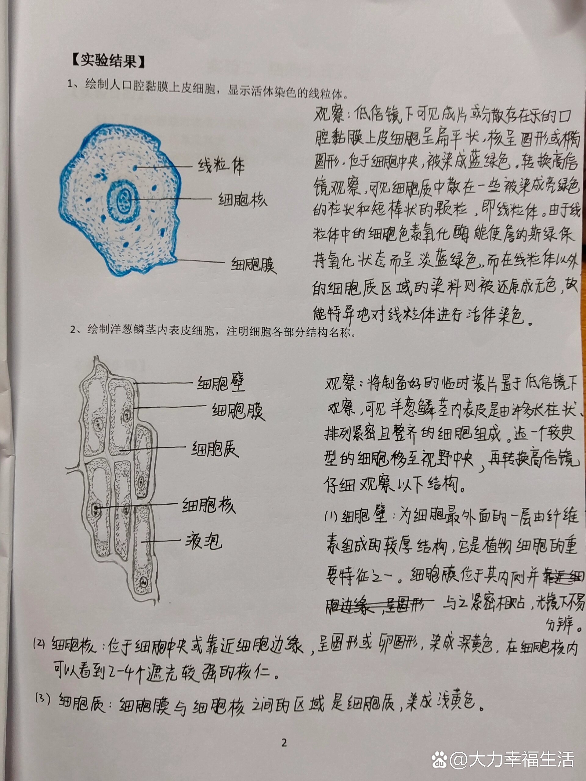 半夏淀粉粒细胞手绘图图片