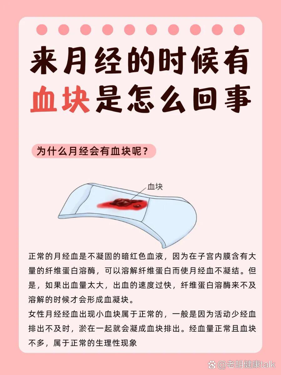 br 经期期间出现血块是一个常见的现象  br 但不能简单地说这是一件