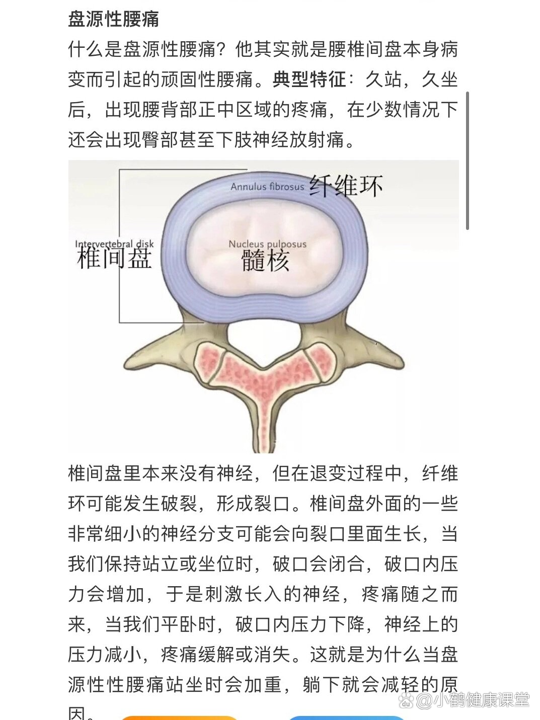 纤维环撕裂之后