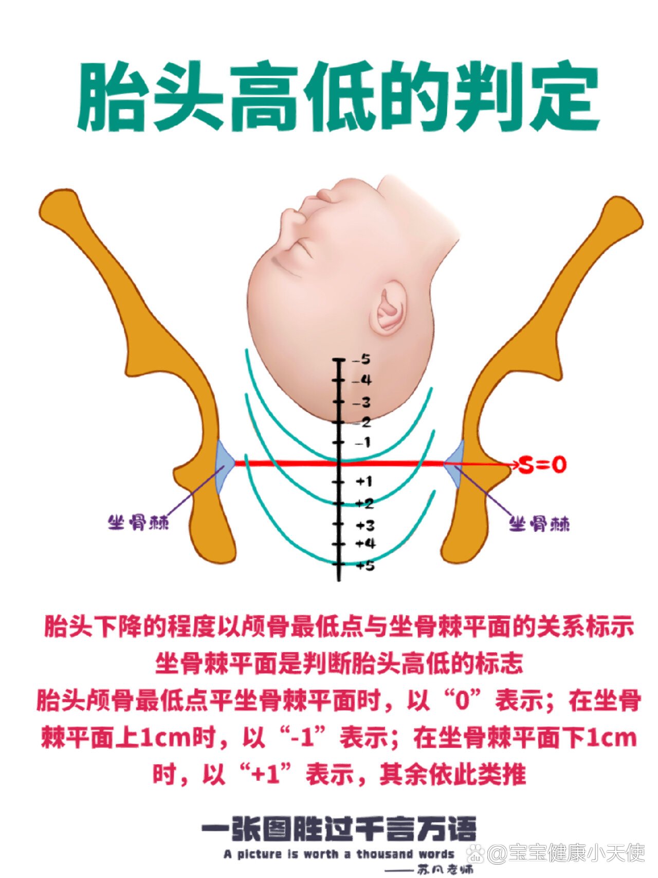 胎头高低的判断