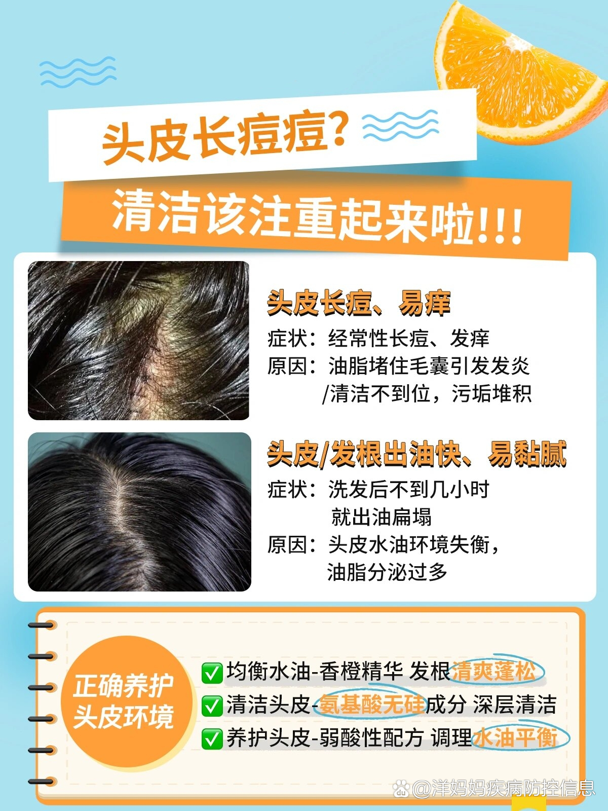 头皮长痘痘71不删6015这篇你一定要看