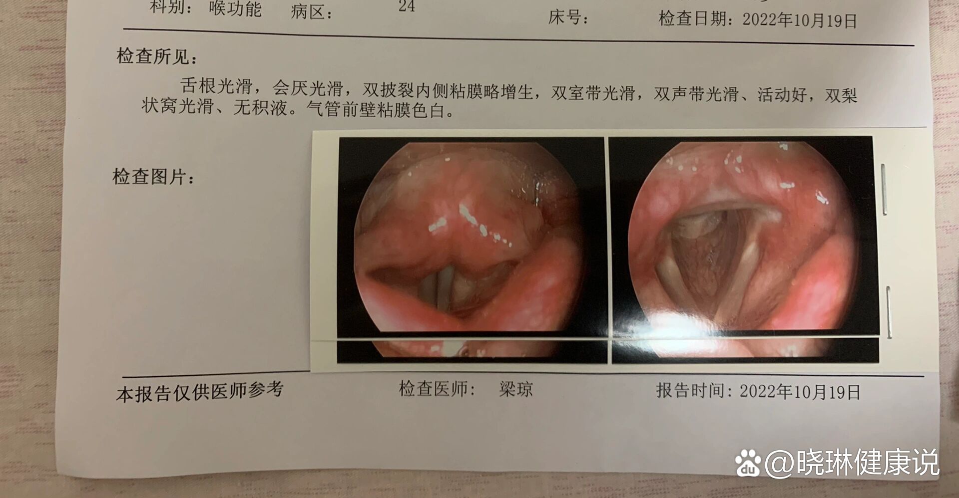 咽炎咽部囊肿图片图片