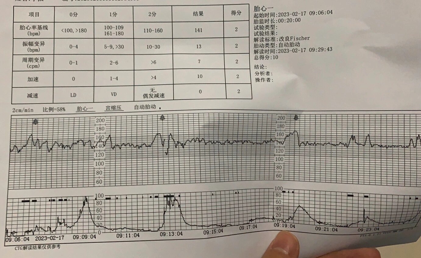 37周听胎心的位置图片图片